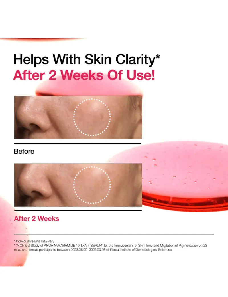 Anua – Niacinamide 10% + TXA 4% Serum